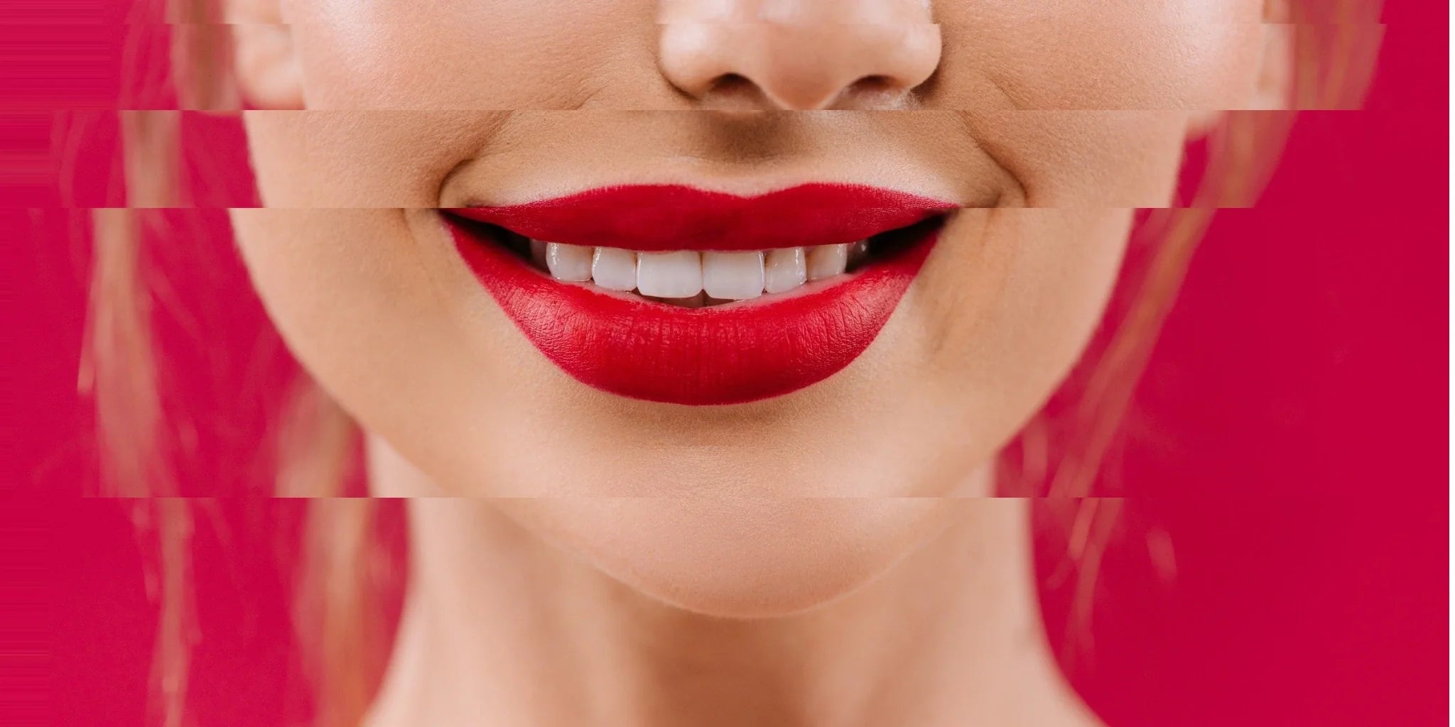 Teeth Whitening - Smart