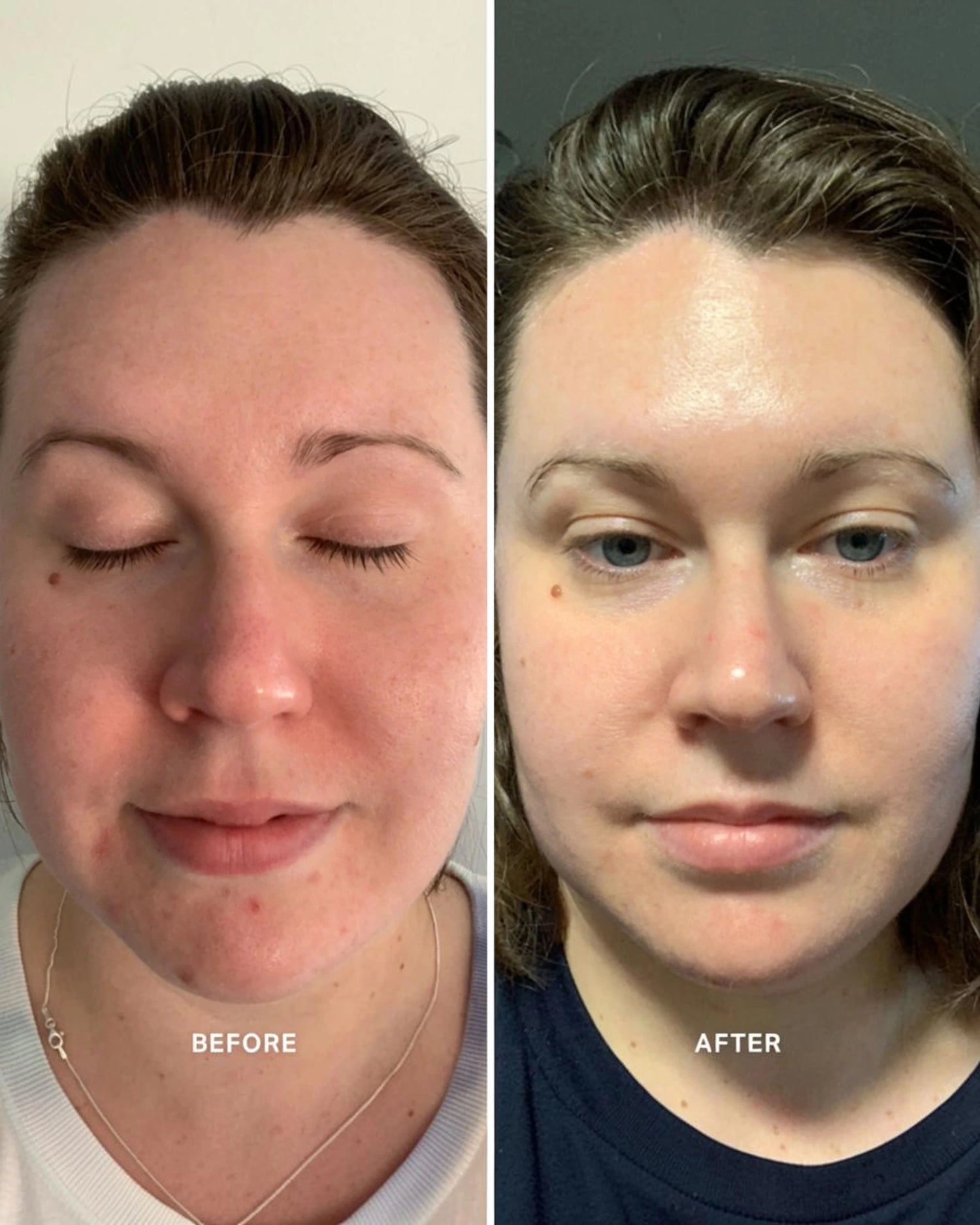 Vitamin A Serum with 0.3% Retinol