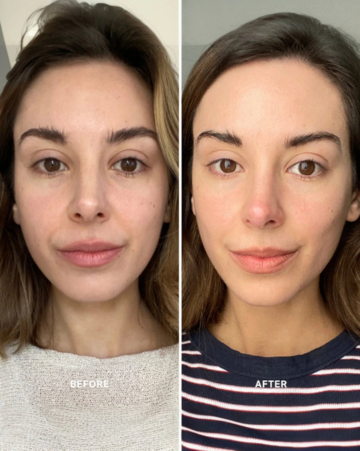 Vitamin C Serum with 10% Ethyl Ascorbic Acid